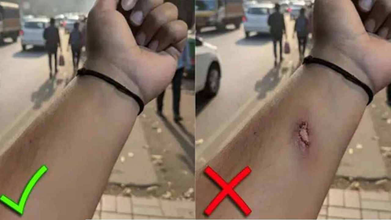 এআই দিয়ে নকল আঘাতের ছবি দিয়ে ছুটি নিলেন অফিস কর্মী