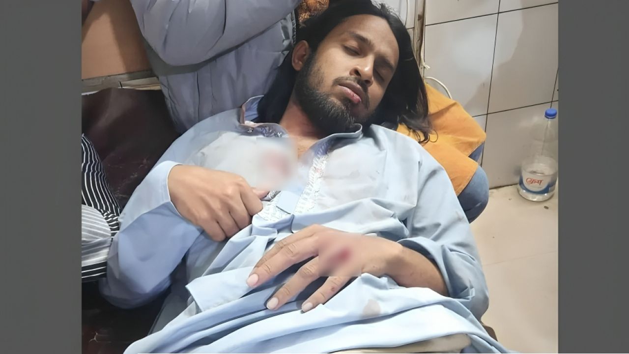 আন্দোলনরত অবস্থায় সংঘর্ষে আহত রাকসুর জিএস সালাউদ্দিন আম্মার