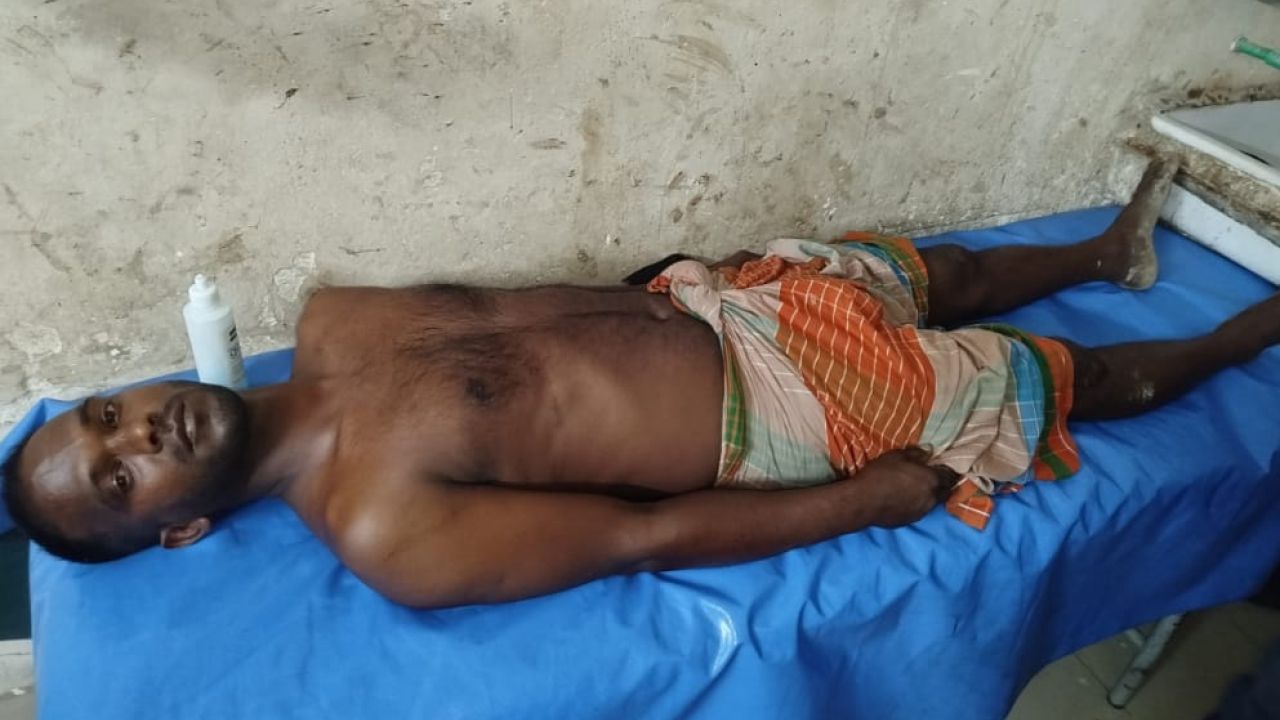 নিজামপুরে কোস্টগার্ডের গোয়েন্দা সদস্যের বিরুদ্ধে নির্যাতনের অভিযোগ, যুবক হাসপাতালে