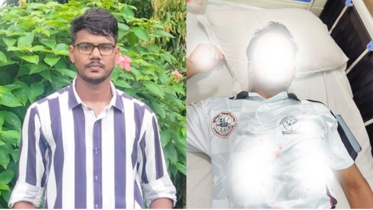 নিজের বন্ধুকে মেরে রক্তাক্ত করলো কুবি শিক্ষার্থী 